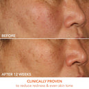 Dr. Dennis Gross Skincare  Vitamin C Lactic 15% Firm & Bright Serum 30ml