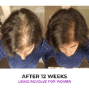 Zenagen Revolve Shampoo Treatment for Women 6.75oz/200ml